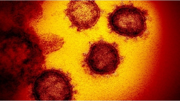 coronaviruscovid19microscopiovirus.jpg