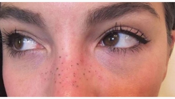 pecas3.jpg